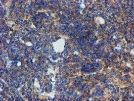 PPAT Antibody (aa42-278, clone OTI1B8)