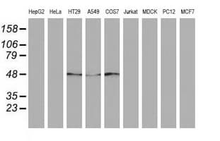 SQSTM1 Antibody (clone OTI4G9)