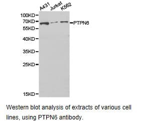 PTPN6 / SHP1 Antibody
