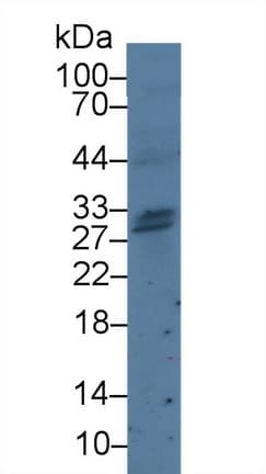 GZMH / Granzyme H Antibody (aa19-246)