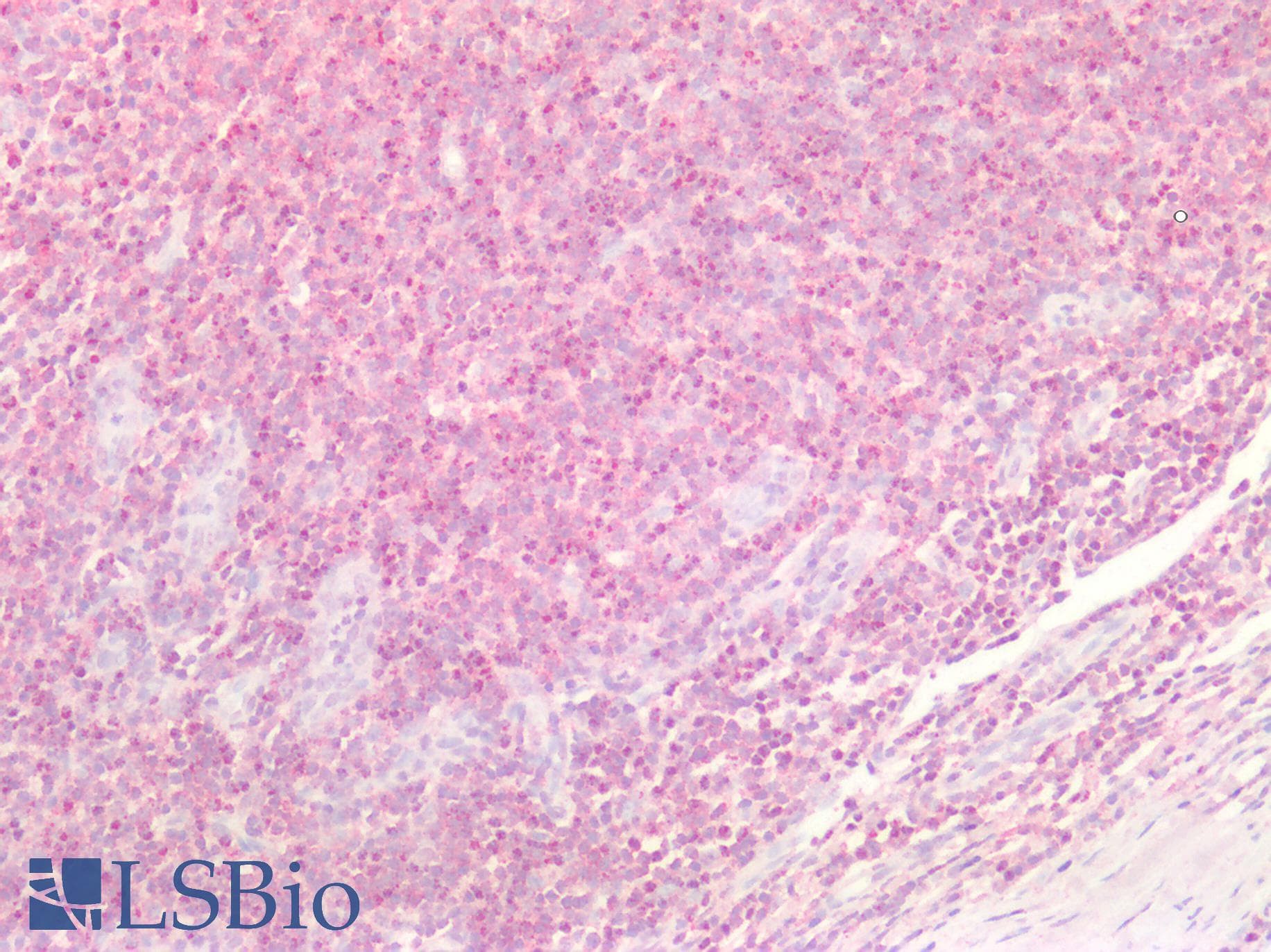 PathPlus™ Requiem / DPF2 Antibody
