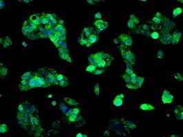 Monoclonal Mouse anti-Human SORD / Sorbitol Dehydrogenase Antibody (clone OTI9E7, IHC, IF, WB)