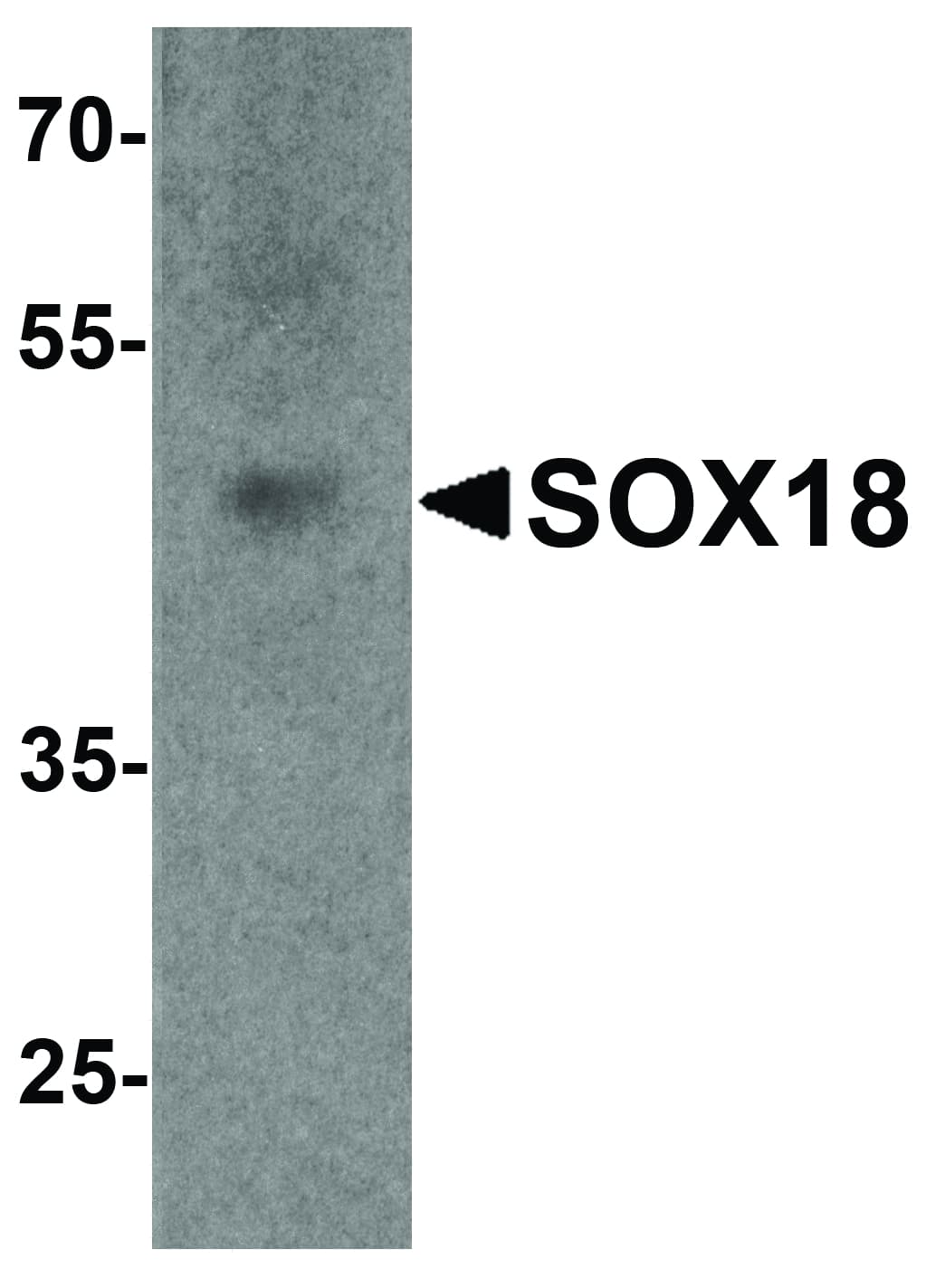 Polyclonal Rabbit anti-Human SOX18 Antibody (WB)