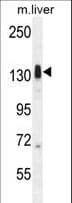 LMTK3 Antibody (aa156-187)
