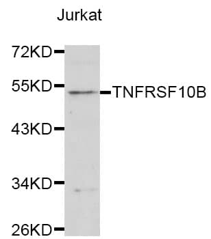Polyclonal Rabbit anti-Human TNFRSF10B / Killer / DR5 Antibody (IHC, WB)