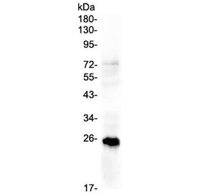 PGF / PLGF Antibody