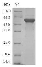 Human E2F6 Protein (Recombinant GST, N-terminus)