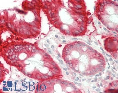 IHC-plus™ Polyclonal Rabbit anti-Human CA12 / Carbonic Anhydrase XII Antibody (aa25-301, IHC, WB)