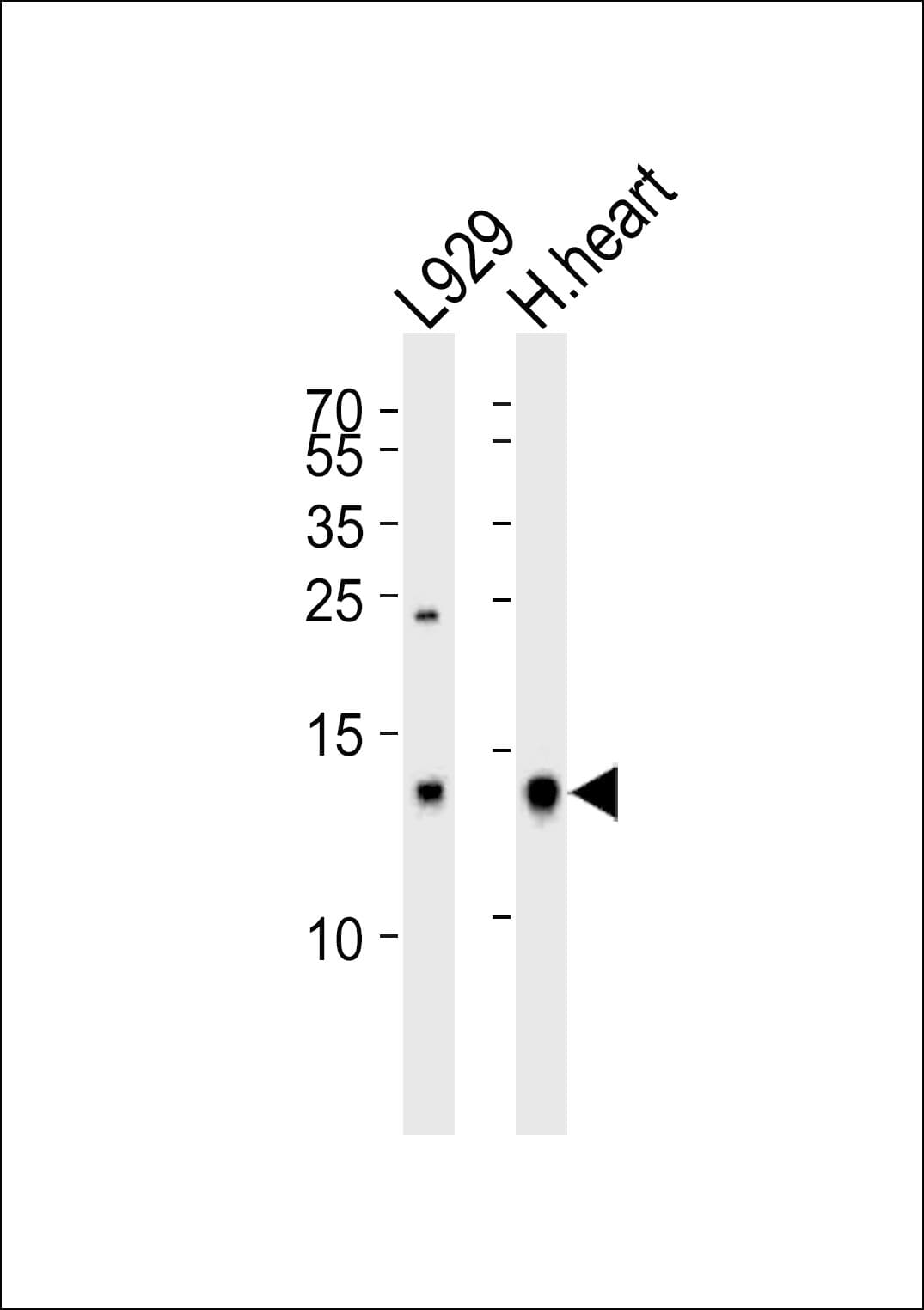 Polyclonal Rabbit anti-Human CYCS / Cytochrome c Antibody (aa21-55, WB)