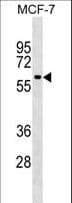 SHOC2 Antibody (aa56-83)