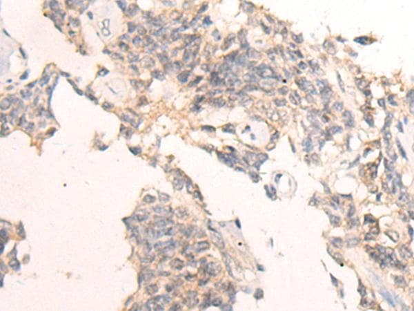 IBA57 / C1orf69 Antibody