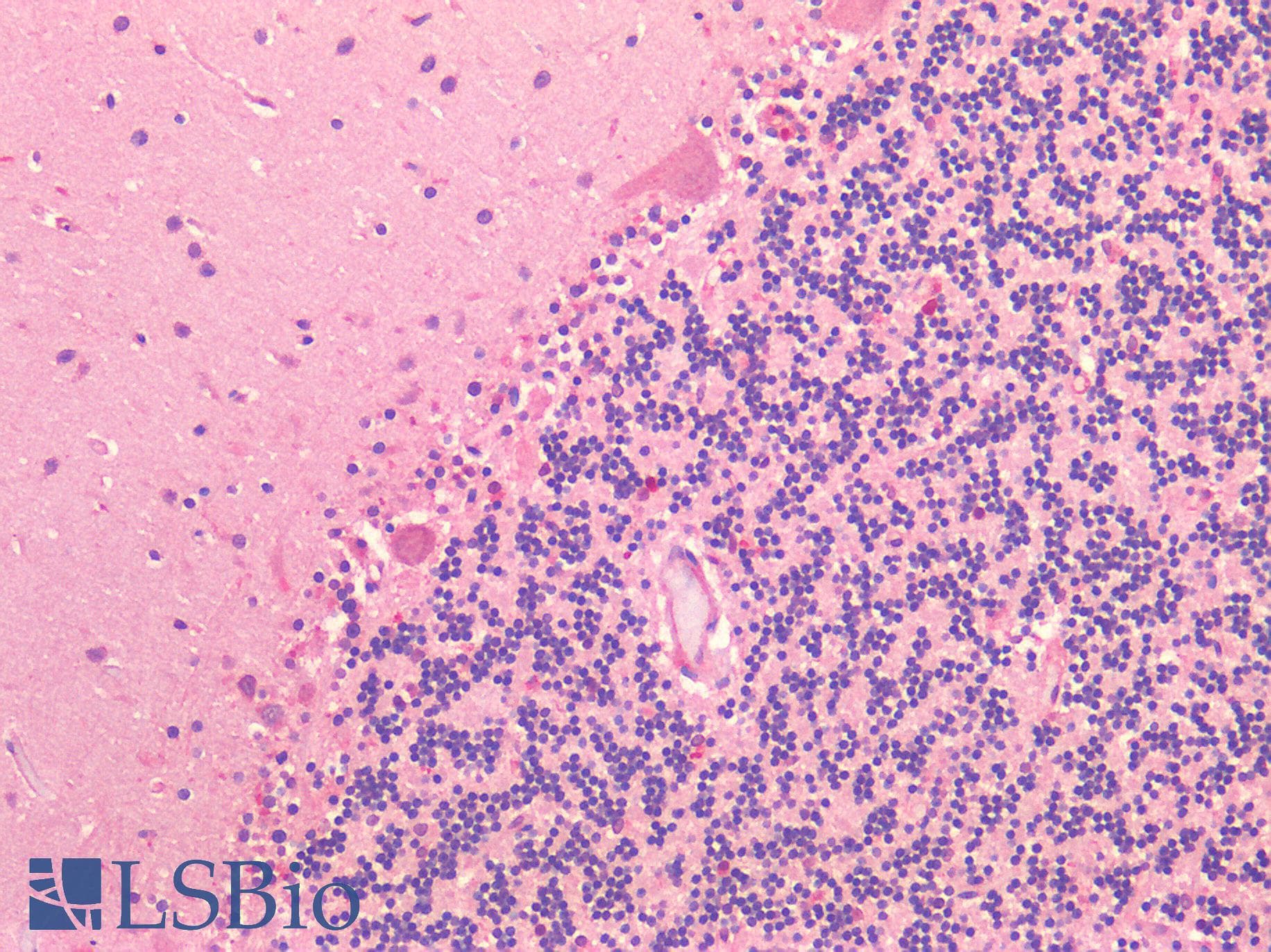 IHC-plus™ CX3CL1 / Fractalkine Antibody