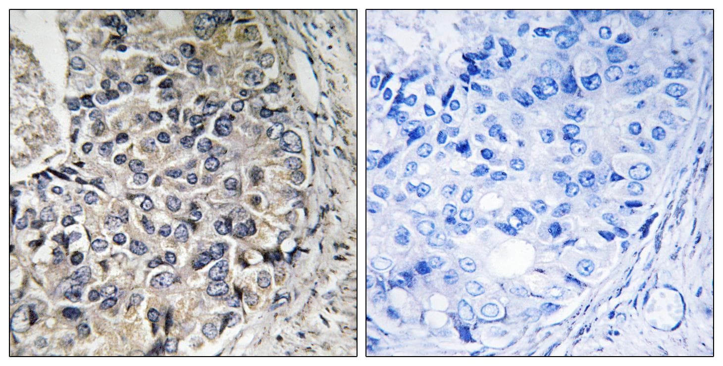 Polyclonal Rabbit anti-Human CMC1 Antibody (IHC)
