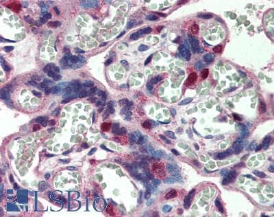 IHC-plus™ SKP2 Antibody (aa1-50)