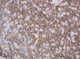 RPN2 / Ribophorin II Antibody (clone OTI1G9)