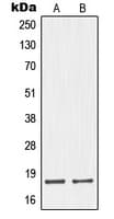 NMS Antibody (C-Terminus)