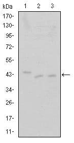 Monoclonal Mouse anti-Human CDK9 Antibody (clone 1B5D10, IHC, WB)