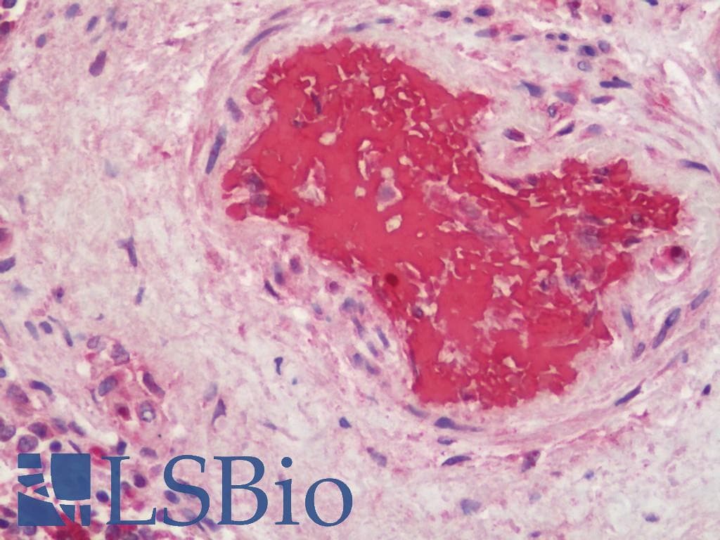 IHC-plus™ HBA1+2 / Hemoglobin Alpha Antibody