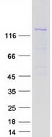 Human TMEM1 / TRAPPC10 Protein (Recombinant Myc-DDK (Flag))