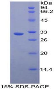 Human NUP88 Protein (Recombinant His-T7)