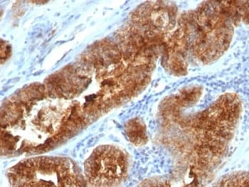 TAG-72 Antibody (clone B72.3 + CC49)