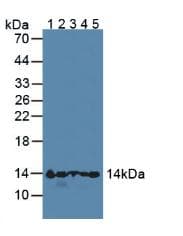 HBA1+2 / Hemoglobin Alpha Antibody (aa1-142)