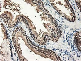 ALS2CR1 / NIF3L1 Antibody (clone OTI3E1)