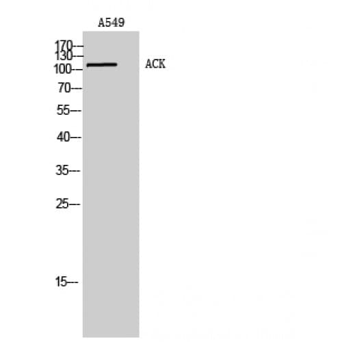 TNK2 / ACK1 Antibody (220-300 aa)