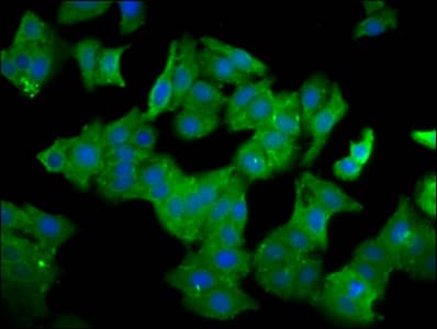Polyclonal Rabbit anti-Human QPRT Antibody (IHC, IF)