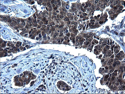 ZFAND3 / TEX27 Antibody (clone OTI1H10)
