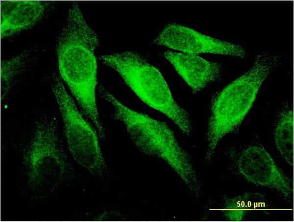Monoclonal Mouse anti-Human CD66c / CEACAM6 Antibody (clone 1G2, IF, WB)