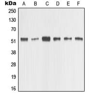 Polyclonal Rabbit anti-Human MMP1 Antibody (C-Terminus, IHC, IF, WB)