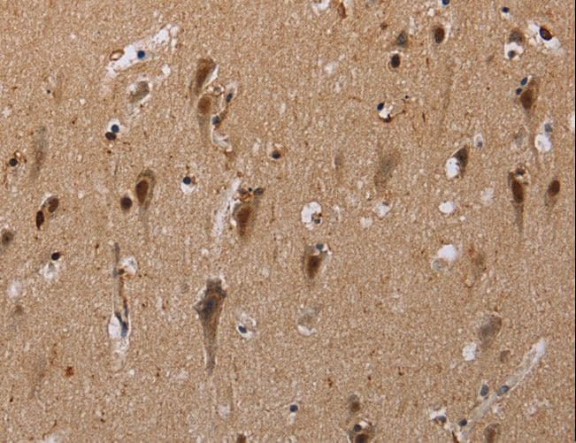 GTF2I / TFII I Antibody