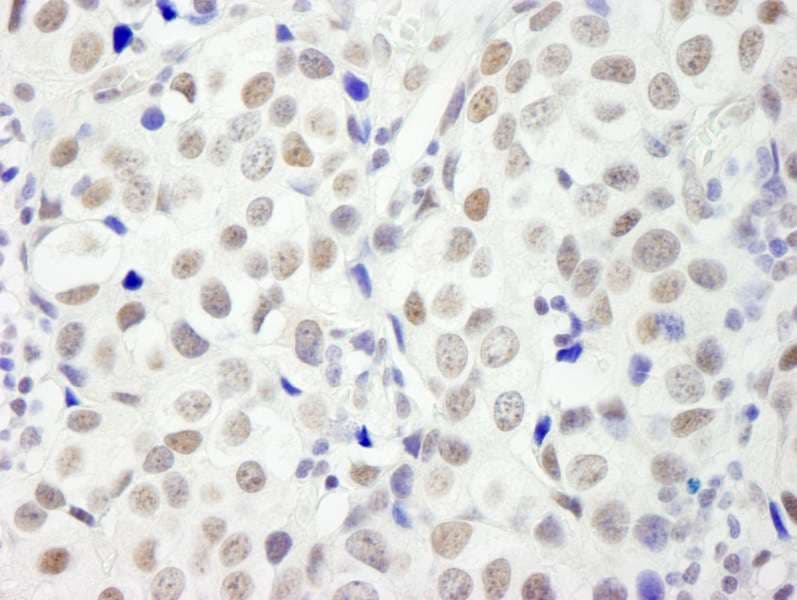DFFA / ICAD / DFF45 Antibody (aa271-331)