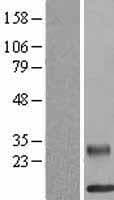 RETNLB / RELM-Beta Protein (Over-Expression Lysate Myc-DDK (Flag))