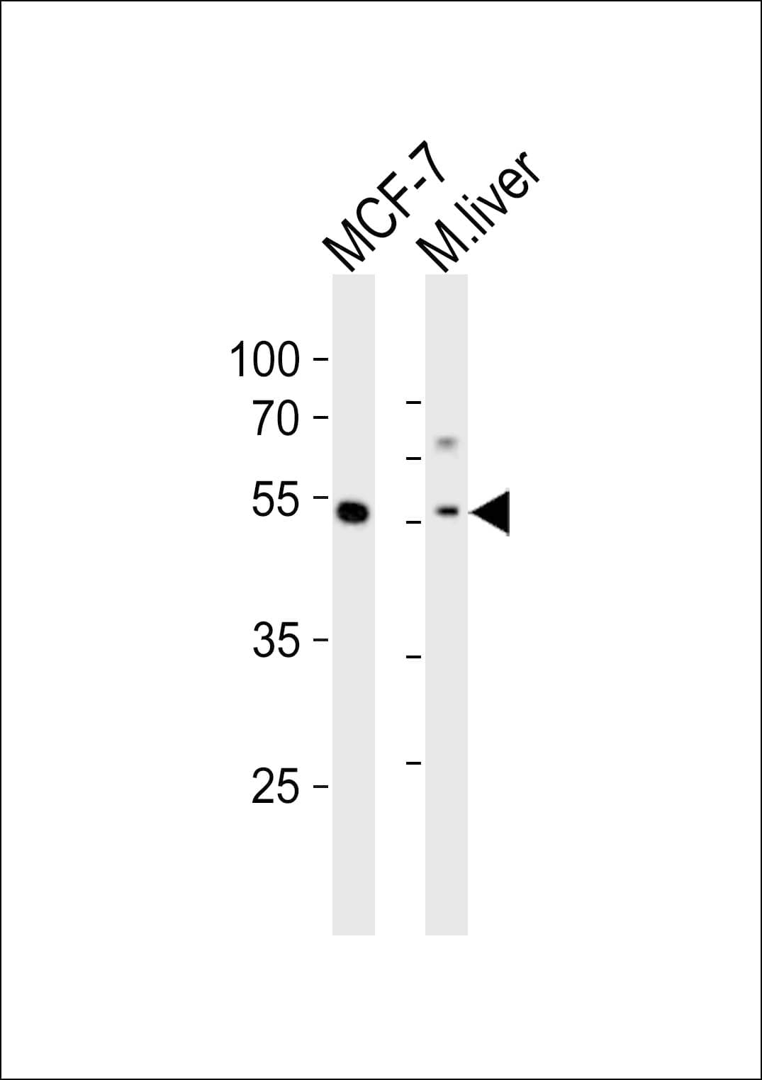 GATA6 Antibody (aa485-518)