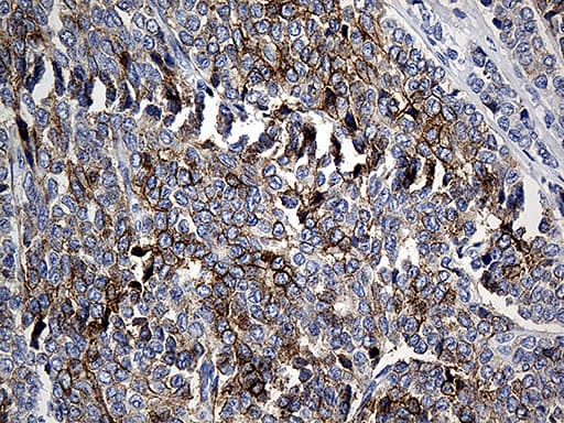 CLEC10A / CD301 Antibody (aa181-293, clone OTI2B10)