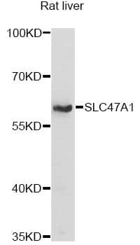 Polyclonal Rabbit anti-Human SLC47A1 / MATE1 Antibody (WB)