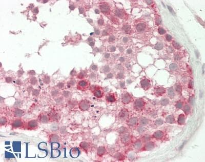 PathPlus™ MTOR Antibody (aa1766-2144, clone 10B4)