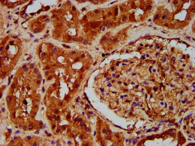 Polyclonal Rabbit anti-Human PTOV1 Antibody (IHC, IF)