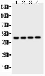 Polyclonal Rabbit anti-Mouse CTSD / Cathepsin D Antibody (aa65-410, IHC, WB)