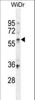 BCO1 / BCMO1 Antibody (aa263-292)