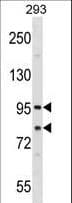 IHC-plus™ SEC23A / COP II Antibody (aa299-328)