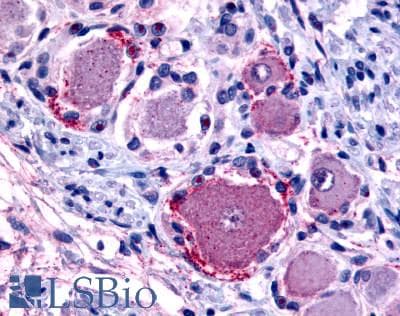 PathPlus™ MRGPRX4 / MRGX4 Antibody (C-Terminus)