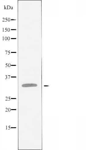 ACKR2 / CCR10 / D6 Antibody