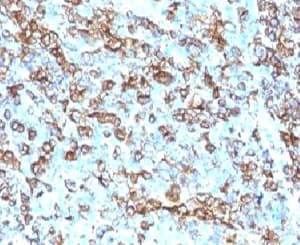 IHC-plus™ HLA-DRB1 Antibody (clone LN3)