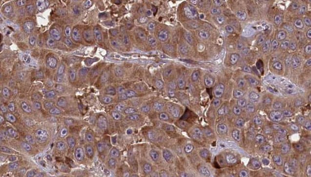 Polyclonal Rabbit anti-Human CNNM3 Antibody (IHC, WB)