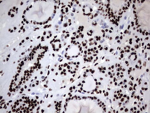 HNRPM / HNRNPM Antibody (aa1-261, clone OTI4C9)