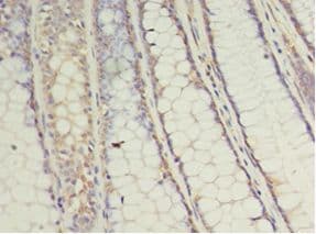 UBCH10 / UBE2C Antibody (aa2-179, HRP)