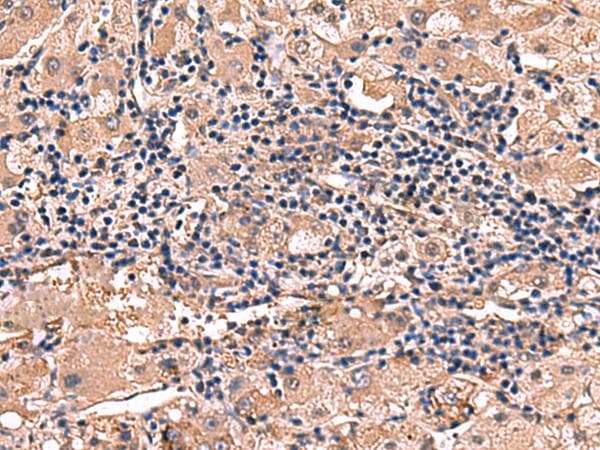Polyclonal Rabbit anti-Human RHAG Antibody (IHC, WB)